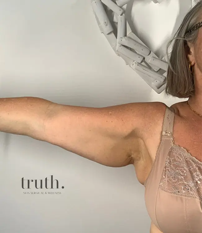 Truth Before and afters (11)