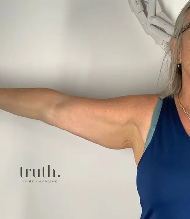 Truth Before and afters (12)
